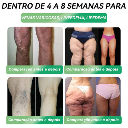 Loja Oficial |𝑯𝑯𝑽𝑩®🌷𝑺𝒐𝒍𝒖çã𝒐 𝒐𝒓𝒂𝒍 𝒍í𝒒𝒖𝒊𝒅𝒂 𝑮𝑳𝑷-1 𝒔𝒆𝒊𝒔 𝒆𝒎 𝒖𝒎 (Somente uma dose por dia, mudanças visíveis em 7 dias) 🌿 Para obesidade, saúde cardiovascular, diabetes, apneia do sono, problemas articulares e muito mais problemas articulares y más.